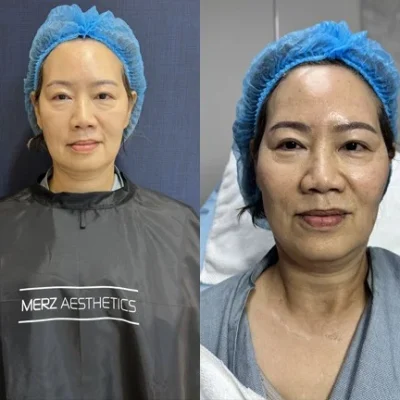 Sea Clinic Treatment 2