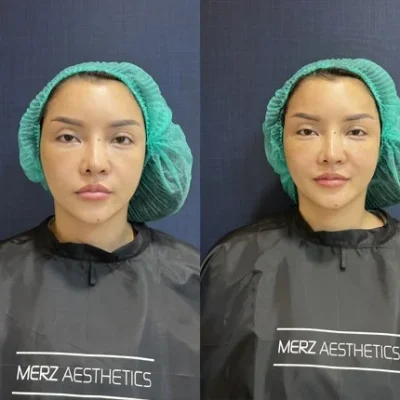 Sea Clinic Treatment 3