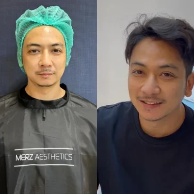 Sea Clinic Treatment 6